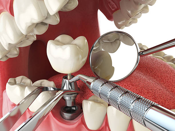 Best Emergency Treatment for Oral Infections in Lake Havasu City, AZ