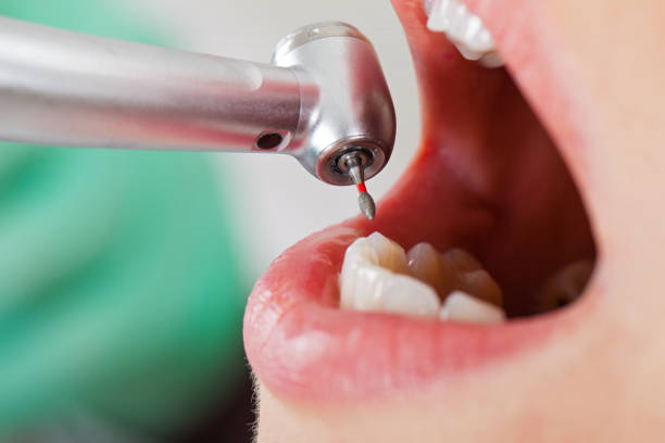 Best Broken or Chipped Tooth Repair in Lake Havasu City, AZ